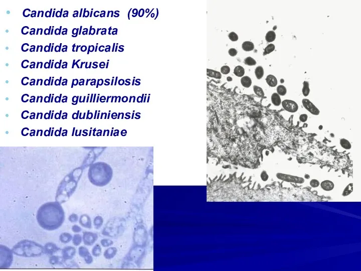 Candida albicans (90%) Candida glabrata Candida tropicalis Candida Krusei Candida