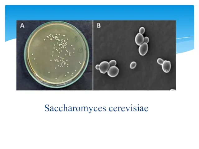 Saccharomyces cerevisiae