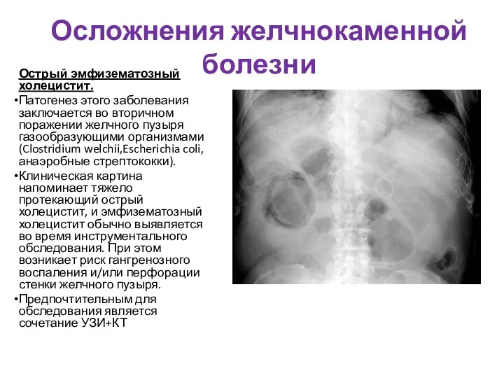 Осложнения желчнокаменной болезни Острый эмфизематозный холецистит. Патогенез этого заболевания заключается