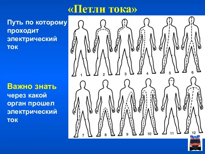 «Петли тока» Важно знать через какой орган прошел электрический ток Путь по которому проходит электрический ток