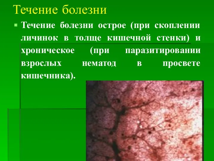 Течение болезни Течение болезни острое (при скоплении личинок в толще