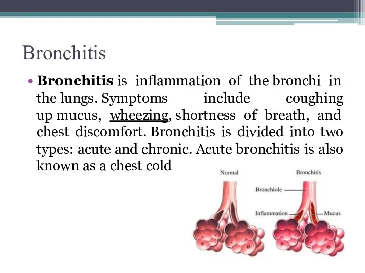 Bronchitis Bronchitis is inflammation of the bronchi in the lungs.