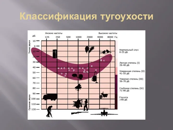 Классификация тугоухости