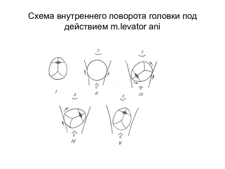 Схема внутреннего поворота головки под действием m.levator ani