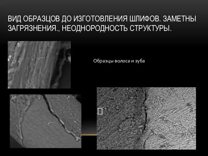 ВИД ОБРАЗЦОВ ДО ИЗГОТОВЛЕНИЯ ШЛИФОВ. ЗАМЕТНЫ ЗАГРЯЗНЕНИЯ., НЕОДНОРОДНОСТЬ СТРУКТУРЫ. Образцы волоса и зуба