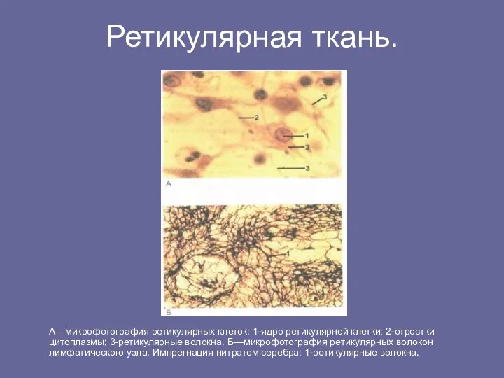 Ретикулярная ткань. А—микрофотография ретикулярных клеток: 1-ядро ретикулярной клетки; 2-отростки цитоплазмы;