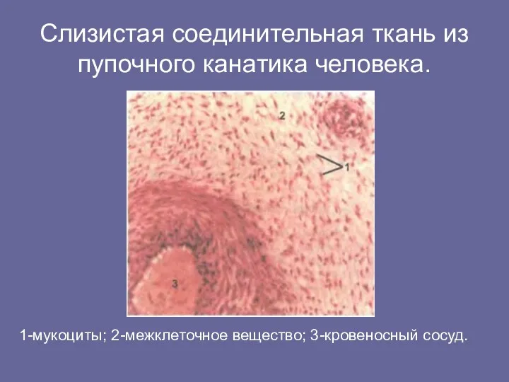 Слизистая соединительная ткань из пупочного канатика человека. 1-мукоциты; 2-межклеточное вещество; 3-кровеносный сосуд.