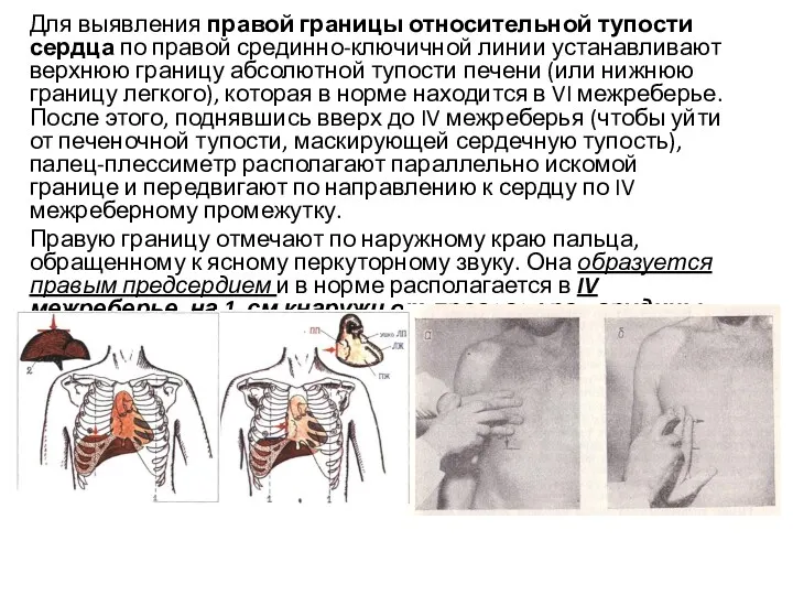 Для выявления правой границы относительной тупости сердца по правой срединно-ключичной