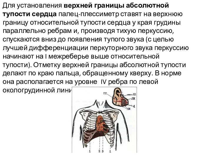 Для установления верхней границы абсолютной тупости сердца палец-плессиметр ставят на