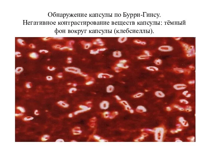 Обнаружение капсулы по Бурри-Гинсу. Негативное контрастирование веществ капсулы: тёмный фон вокруг капсулы (клебсиеллы).