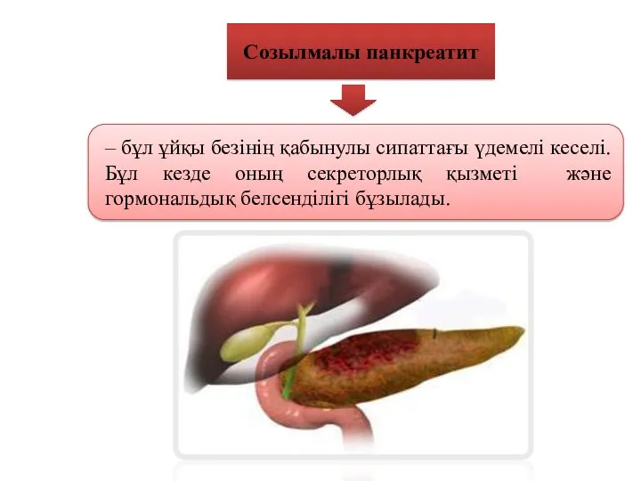 Созылмалы панкреатит – бұл ұйқы безінің қабынулы сипаттағы үдемелі кеселі.