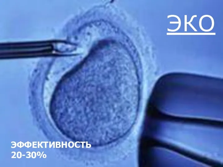 ЭКО ЭФФЕКТИВНОСТЬ 20-30%