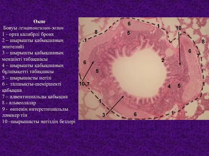 Өкпе Бояуы гематоксилин-эозин 1 - орта калибрлі бронх 2 –