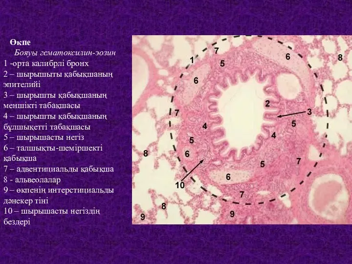 Өкпе Бояуы гематоксилин-эозин 1 -орта калибрлі бронх 2 – шырышыты