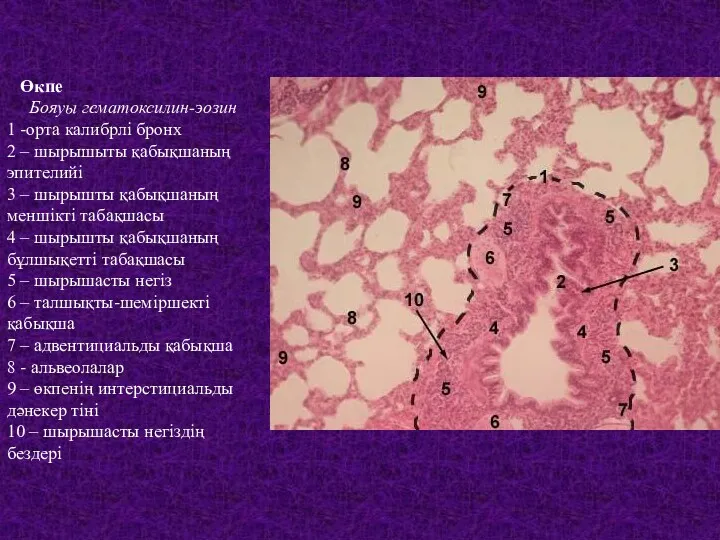 Өкпе Бояуы гематоксилин-эозин 1 -орта калибрлі бронх 2 – шырышыты
