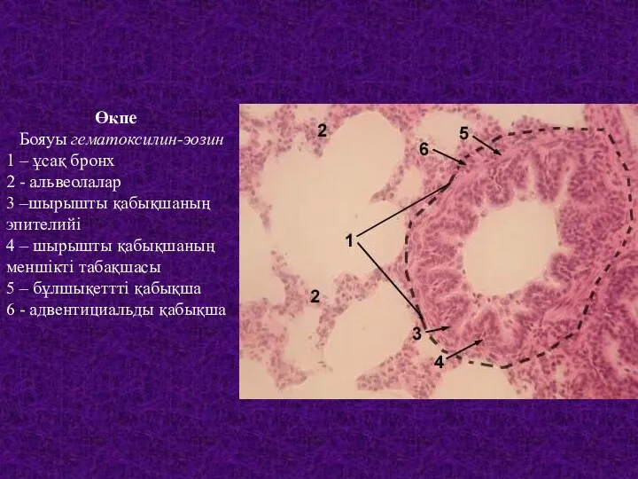 Өкпе Бояуы гематоксилин-эозин 1 – ұсақ бронх 2 - альвеолалар