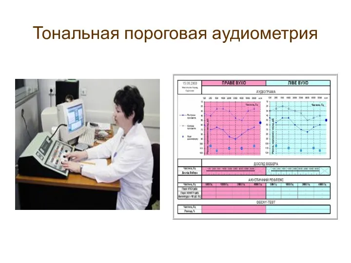 Тональная пороговая аудиометрия