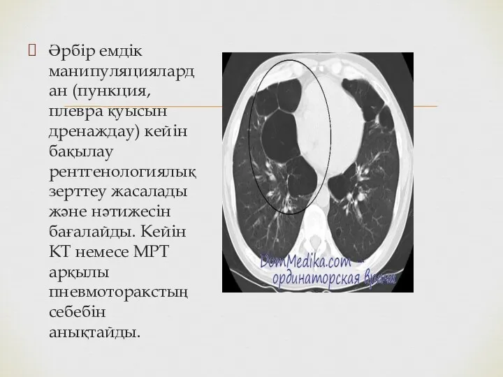 Әрбір емдік манипуляциялардан (пункция, плевра қуысын дренаждау) кейін бақылау рентгенологиялық