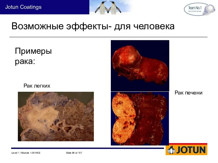 Примеры рака: Возможные эффекты- для человека Рак легких Рак печени