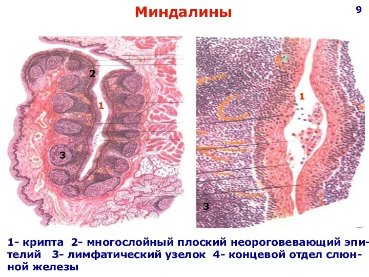 Миндалины 1 1 2 2 3 3 1- крипта 2-