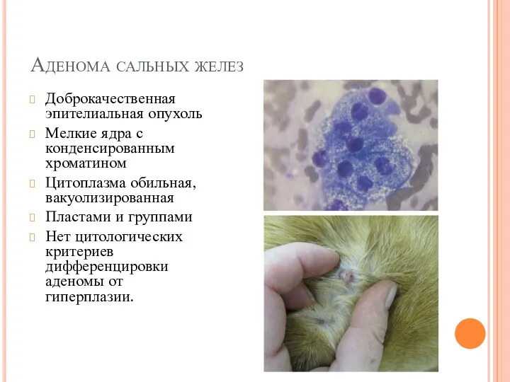 Аденома сальных желез Доброкачественная эпителиальная опухоль Мелкие ядра с конденсированным