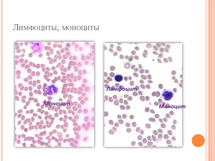 Лимфоциты, моноциты