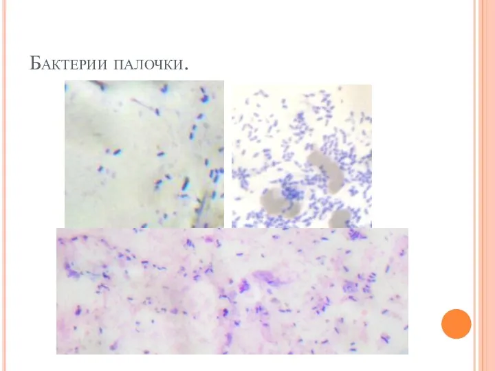 Бактерии палочки.