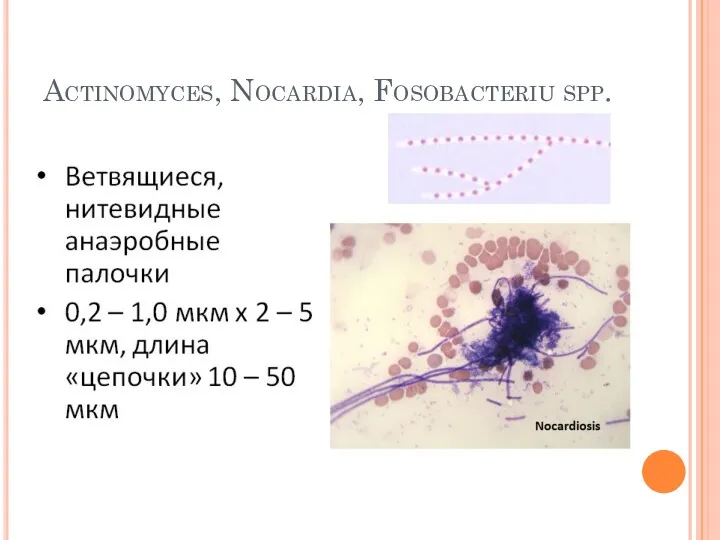 Actinomyces, Nocardia, Fosobacteriu spp.