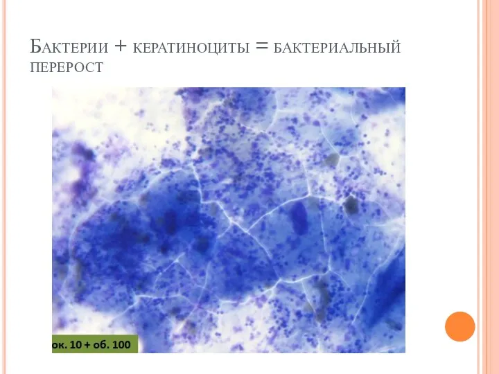 Бактерии + кератиноциты = бактериальный перерост