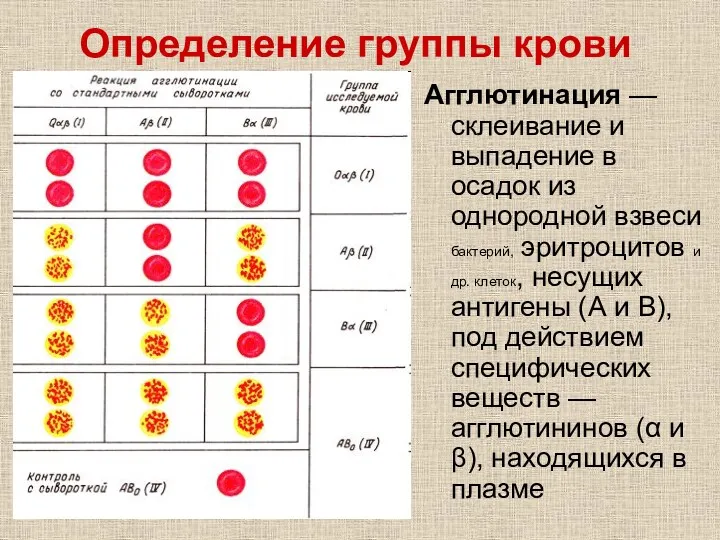 Определение группы крови Агглютинация — склеивание и выпадение в осадок