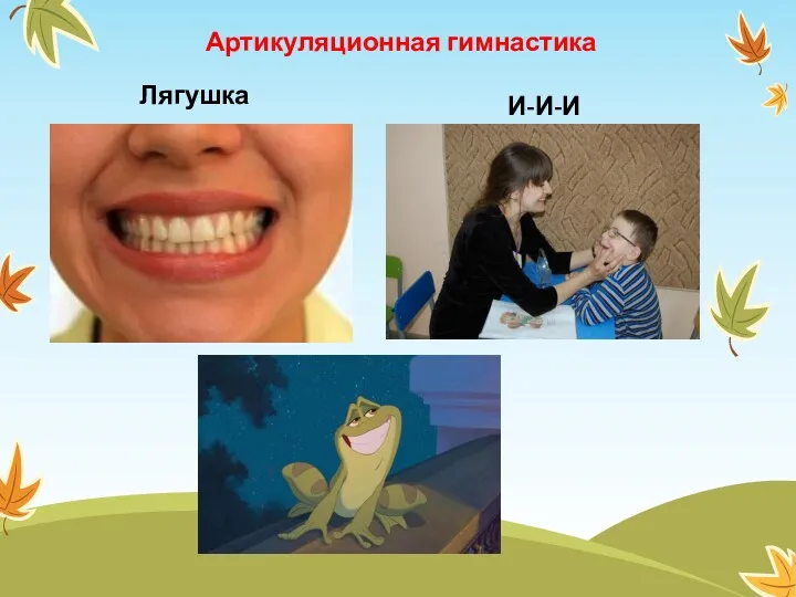 Лягушка И-И-И Артикуляционная гимнастика