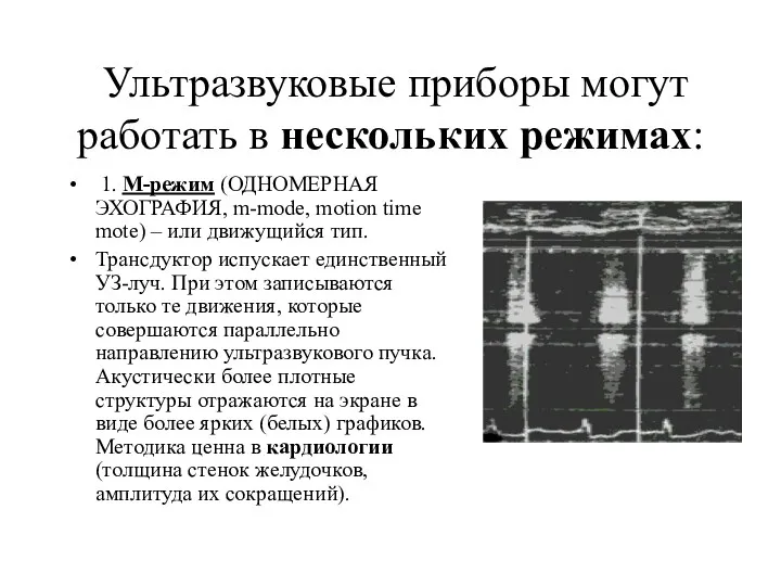 Ультразвуковые приборы могут работать в нескольких режимах: 1. М-режим (ОДНОМЕРНАЯ