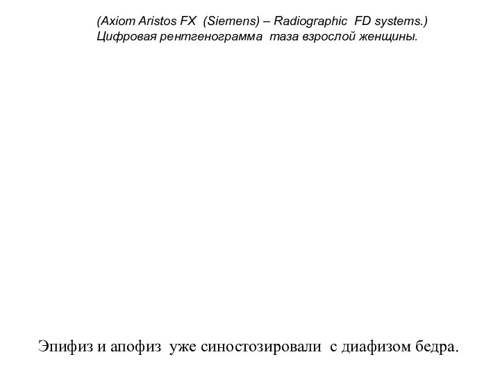 (Axiom Aristos FX (Siemens) – Radiographic FD systems.) Цифровая рентгенограмма