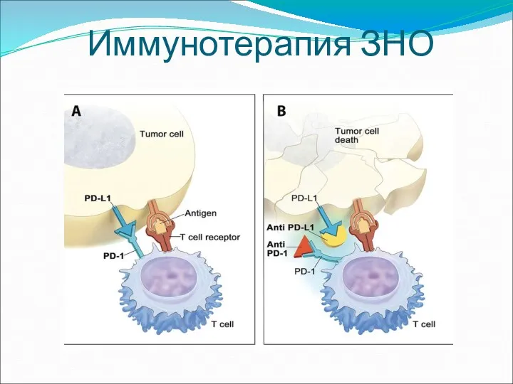 Иммунотерапия ЗНО