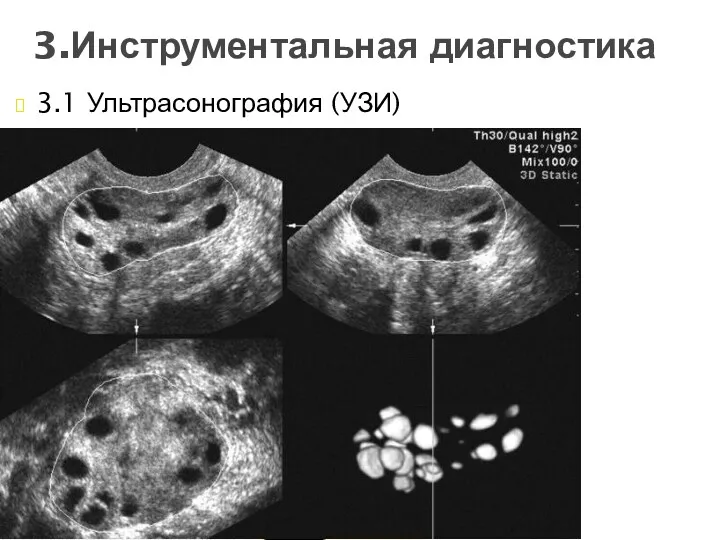 3.1 Ультрасонография (УЗИ) 3.Инструментальная диагностика