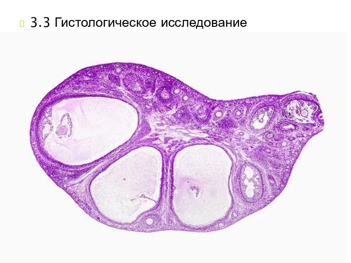 3.3 Гистологическое исследование