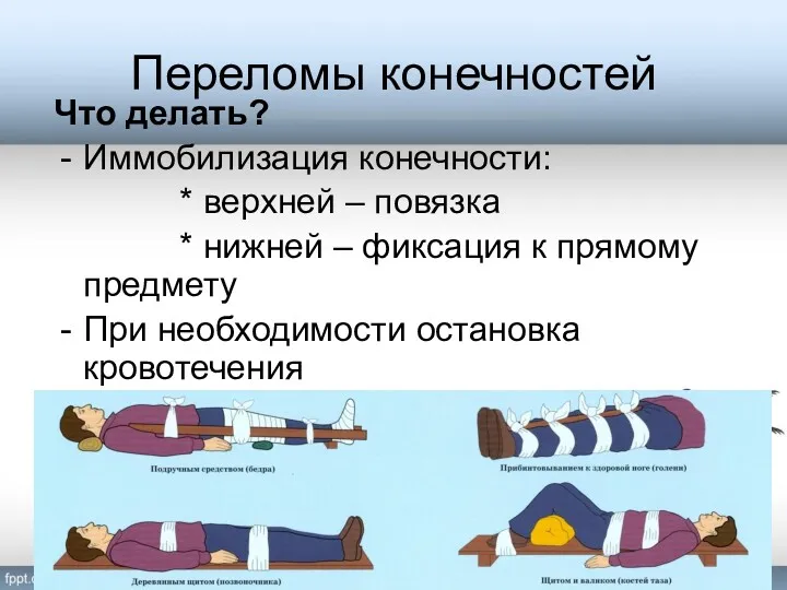 Переломы конечностей Что делать? Иммобилизация конечности: * верхней – повязка