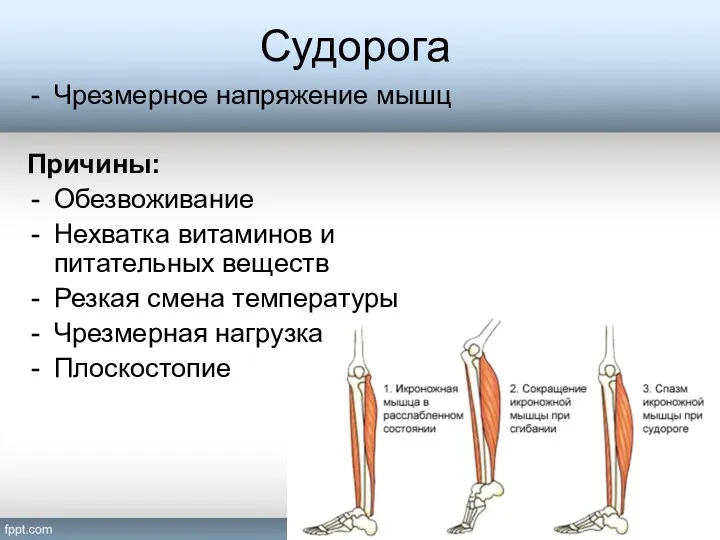 Судорога Чрезмерное напряжение мышц Причины: Обезвоживание Нехватка витаминов и питательных веществ Резкая смена