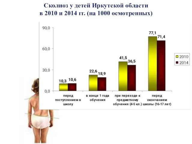 Сколиоз у детей Иркутской области в 2010 и 2014 гг. (на 1000 осмотренных)