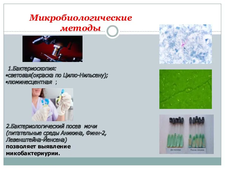 Микробиологические методы 1.Бактериоскопия: световая(окраска по Цилю-Нильсену); люминесцентная ; 2.Бактериологический посев