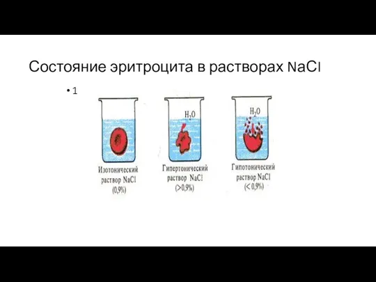 Состояние эритроцита в растворах NаСI 1