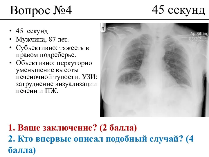 Вопрос №4 45 секунд Мужчина, 87 лет. Субъективно: тяжесть в