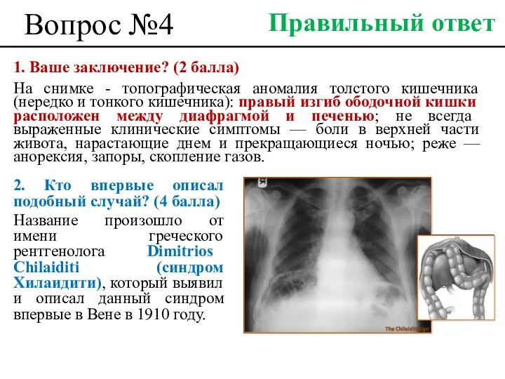 Вопрос №4 2. Кто впервые описал подобный случай? (4 балла)