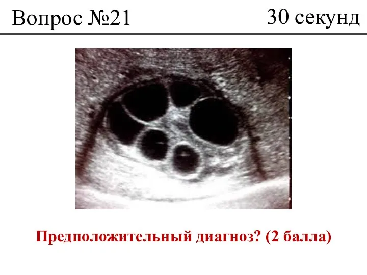 Вопрос №21 Предположительный диагноз? (2 балла) 30 секунд