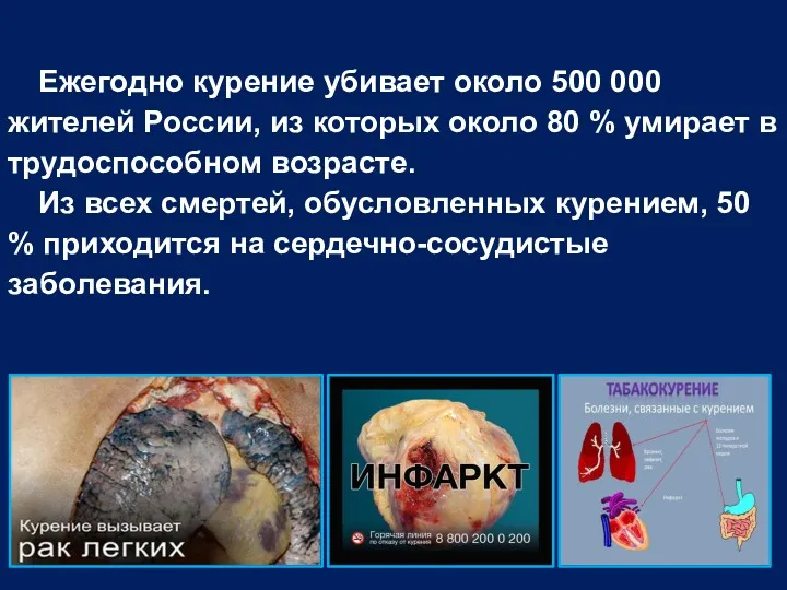Ежегодно курение убивает около 500 000 жителей России, из которых около 80 %