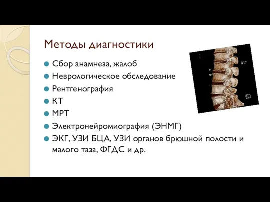 Методы диагностики Сбор анамнеза, жалоб Неврологическое обследование Рентгенография КТ МРТ