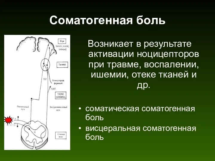 Соматогенная боль Возникает в результате активации ноцицепторов при травме, воспалении,