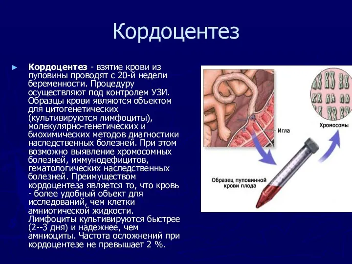 Кордоцентез Кордоцентез - взятие крови из пуповины проводят с 20-й