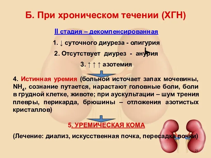 Б. При хроническом течении (ХГН) II стадия – декомпенсированная 1.