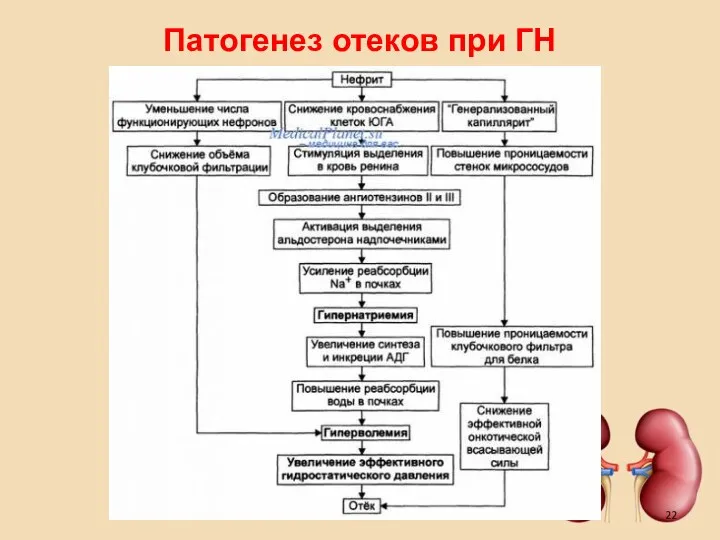 Патогенез отеков при ГН